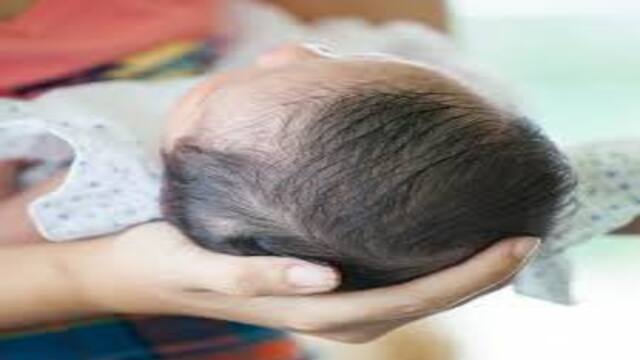 Produk Penumbuh Rambut Bayi yang Efektif dan Teruji